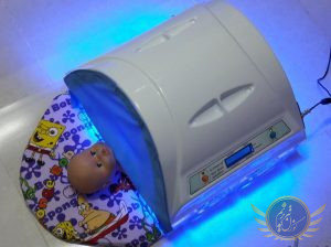 درمان زردی نوزادان(فتوتراپی علیپور)اجاره دستگاه